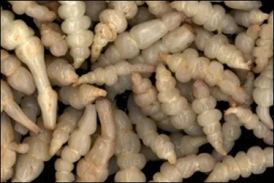 Le dessinateur de bandes dessinées Pozla, raconte dans son album "Carnet de santé foireuse" l'affection dont il était atteint. C'était...