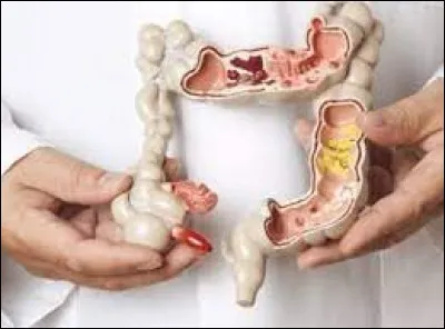 Sciences et nature : Quel adjectif attribue-t-on à un trouble du fonctionnement de l'intestin sans gravité, entrainant des douleurs et des ballonnements ?