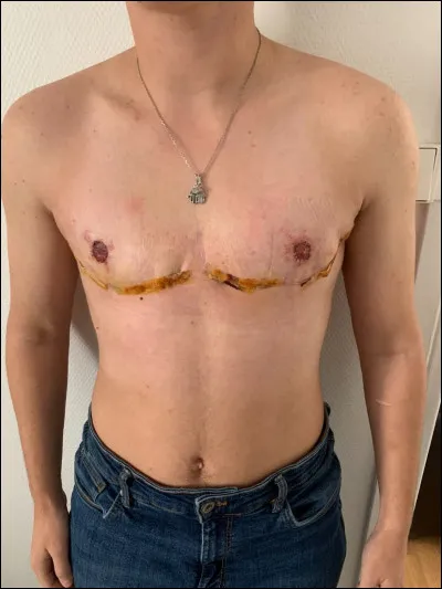 Quand est la journée internationale de visibilité transgenre ?