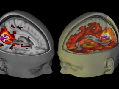 Le LSD est considéré comme une drogue...