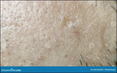 À quel animal ces poils appartiennent-ils ?