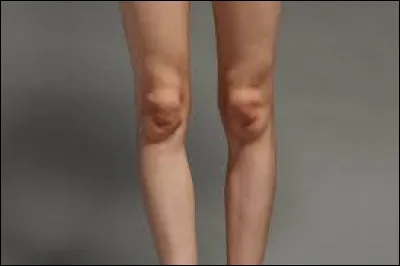 Tout le monde en a ! Ce sont les...