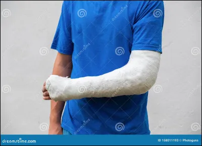 Un ami sest cassé le bras et est à lhôpital, tu es/dis