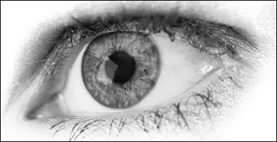 Quel est le nom de la maladie qui fait que les patients qui en souffrent ne voient qu'en noir et blanc ?