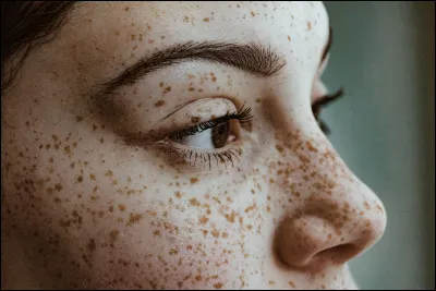 Quelle est l'actrice qui n'a pas de taches de rousseur ?
