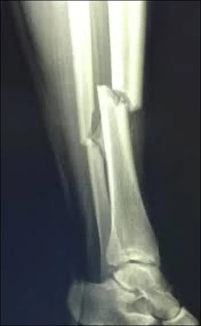 Quelle lettre faut-il enlever pour obtenir une addition souvent malvenue ?