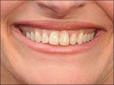 Quelle star se cache derri&egrave;re ce sourire ?