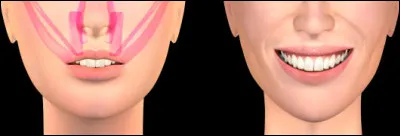 Quels muscles rentrent en action lorsque nous sourions ?