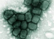 Quiz La variole