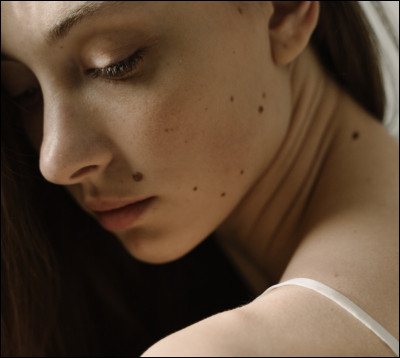 Comment dit-on en anglais "grain de beauté" ?