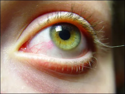 Quelle couleur d'yeux veux-tu ?