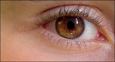 Comment appelle-t-on la substance g&eacute;latineuse qui se situe entre le cristallin et la r&eacute;tine ?