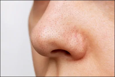 Comment est ton nez ?