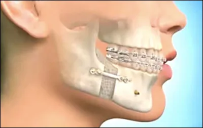 Traduisez "mâchoire" en Vieux Norrois :