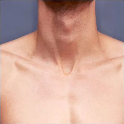 En Vieux Norrois, "cou" se dit...