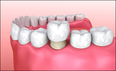Comment s'appelle la partie visible de la dent ?