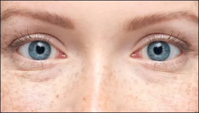 Et tes yeux ?