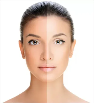 Comment est ta peau ?