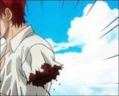 Comment Shanks a-t-il perdu son bras ?