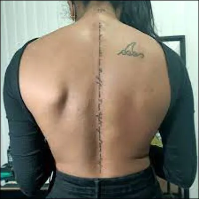 Comment dit-on "colonne vertébrale" ?