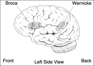 ''Ça alors, je suis en sueur, je suis terriblement nerveux, vous savez, de temps en temps, je me laisse rattraper, je ne peux pas être rattrapé, je ne dirai rien du gourcias, voilà un mois [...] il faut que je courre à droite à gauche, que je surveille, le narbot et tous ces trucs...''
Exemple parlant des troubles du langage dans l'aphasie de Wernicke. Que sont ''narbot'' et ''gourcias'' ?