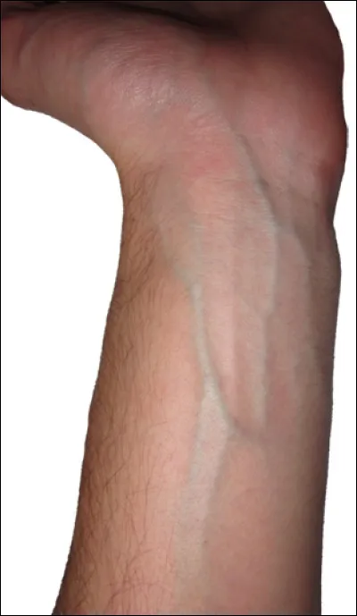 Quelle lettre faut-il remplacer pour obtenir une punition ?