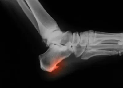 Quel animal est un kakapo ?