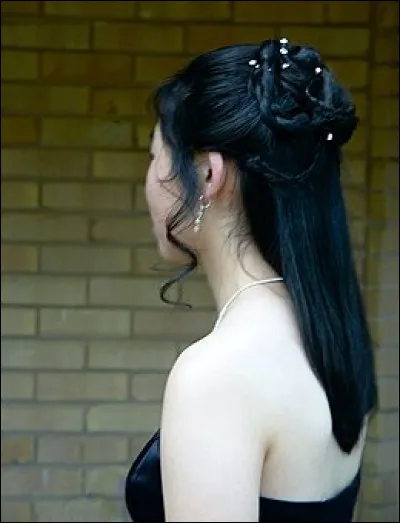 Comment s'appelle la douleur de l'épaule, de l'omoplate ?