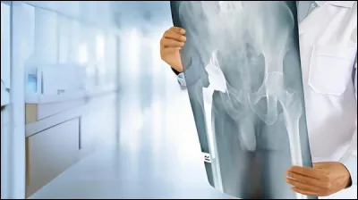 Quel est le plus grand os du corps humain ?