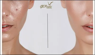 Est-ce que tu brilles ?