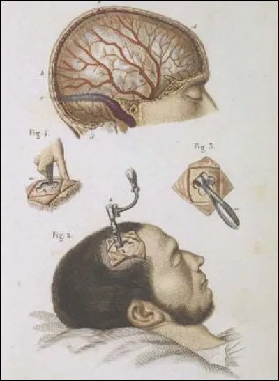 Son père Joseph Kennedy va alors prendre une décision terrible pour elle, qu'il regrettera probablement toute sa vie. 
Quelle est-elle ?