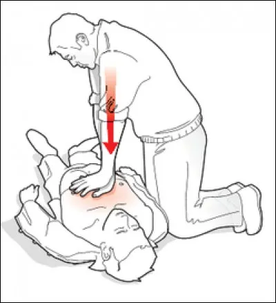 En cas d'arrêt cardio-respiratoire, il n'est pas nécessaire de pratiquer un massage cardiaque. L'utilisation d'un défibrillateur est suffisante.
