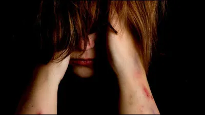 Quel acte, qui témoigne dun mal-être, a tendance à être trois fois plus commis chez les personnes de la communauté gothique (en particulier chez les adolescents) que dans la population générale ?