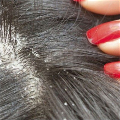 Qu'est-ce qu'une pellicule ?