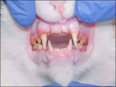 Quest-ce quune gingivite ?