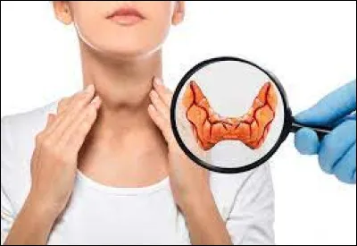 Insuffisance de sécrétion d'une glande située à la base du cou :