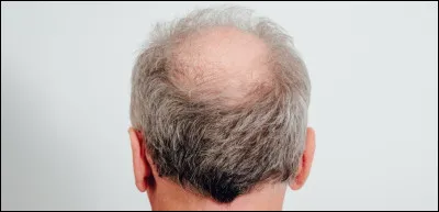 François de Sales est d'originaire de Savoie et a été ordonné prévôt du chapitre de Genève. Il n'a jamais pu exercer son ministère dans cette ville où un autre personnage faisait de l'ombre. Qui était-il ?