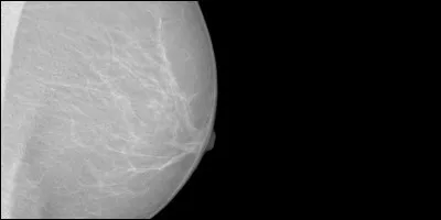 Quelle information est FAUSSE concernant le dépistage organisé du cancer du sein ?