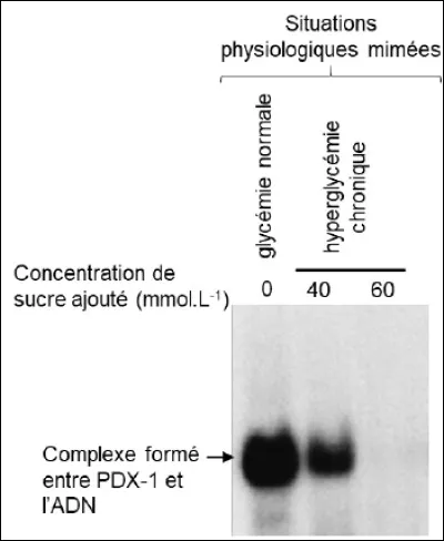 Document 2b. Étude de linteraction entre PDX-1 et le promoteur du gène de linsuline
Ils ont extrait les protéines PDX1 des noyaux des cellules et les ont incubées avec des fragments dADN ayant la séquence nucléotidique du promoteur du gène de linsuline. Après avoir réalisé une électrophorèse, les complexes formés entre le fragment dADN et la protéine sont révélés par l'intensité de la bande.