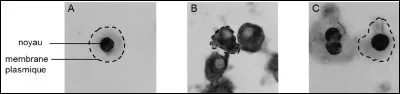 Des chercheurs ont marqué les protéines PDX-1 dans des cellules β de pancréas sans traitement particulier (A), après un traitement provoquant un stress oxydatif (B) ou après un traitement provoquant un stress oxydatif en présence dun antioxydant (C). Pour repérer la protéine PDX-1, des anticorps anti-PDX1 ont été utilisés. Leur fixation est révélée par une coloration sombre.
