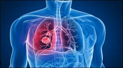 La tuberculose se transmet principalement par :