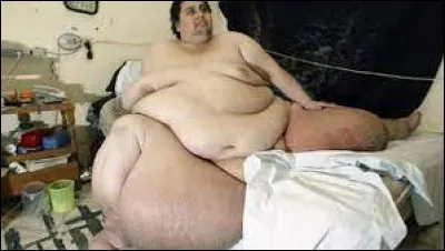 Au sortir de l'Empire romain, Amiens plonge dans le Moyen-Âge. Un gros tirage de couverture entre les comtes et l'évêque. En 1115, quel roi des Francs assiège Amiens afin de soutenir l'évêque Geoffroy ?