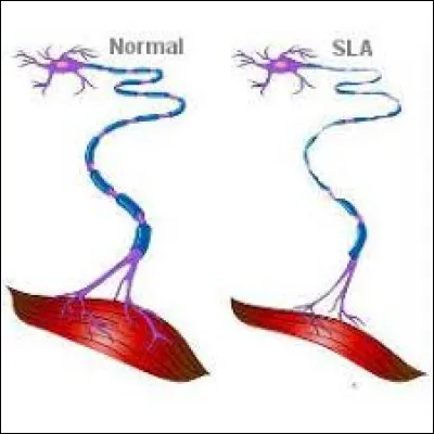 En quelle année Lou Gehrig avait-il été diagnostiqué de cette maladie ?
