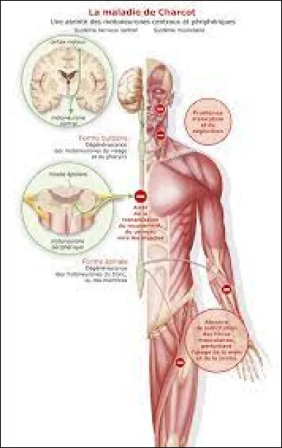 Comment Hawking a-t-il continué à communiquer malgré la maladie ?