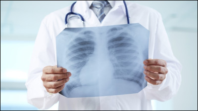 Quels sont les rayons utilisés pour radiographier les os ?