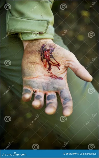 Vous marchez seul(e) dans la forêt, déversant vos larmes car votre conjoint(e), qu'importe la situation, est mort(e), soit mordu(e) par les zombies soit mort(e) de ses blessures. Un zombie vous a mordu la main (celle que vous utilisez le plus). Vous vous débarrassez du zombie mais le temps presse ; si vous restez comme cela, dans peu de temps vous serez un zombie !
Que faites-vous ?