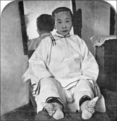 Où fut pratiquée la coutume des "pieds bandés" ?