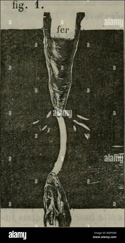 Si vous pandiculez, que faite-vous ?