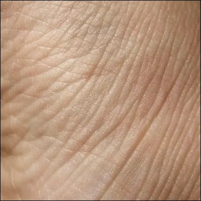 Ta peau est-elle sensible ?