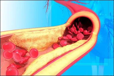 Quelle information est fausse à propos du cholestérol ?